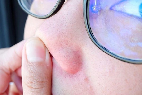 「命定卸妝膏」推薦