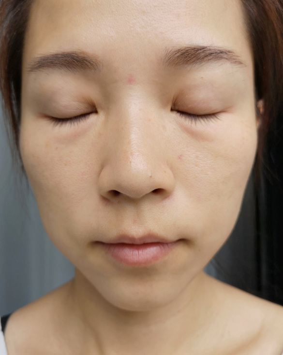 幫我臉蛋神救援