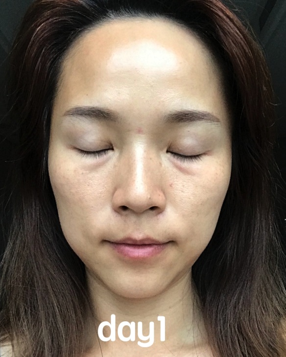 幫我臉蛋神救援